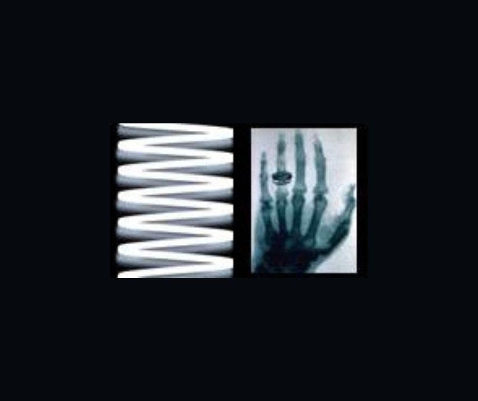X-Rays