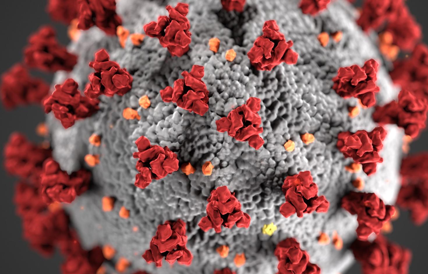 A picture of covid 19 virus