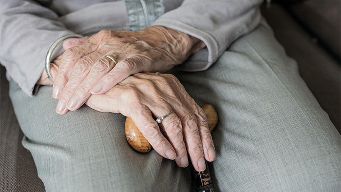 Aging hands