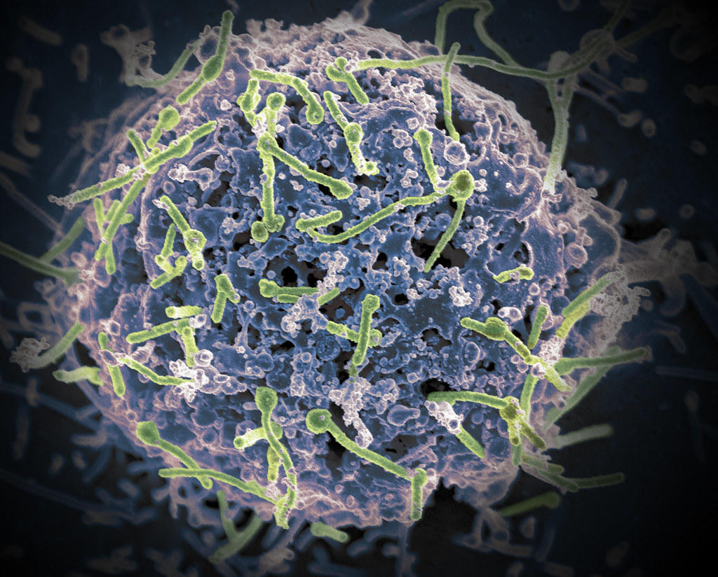 Ebola strain