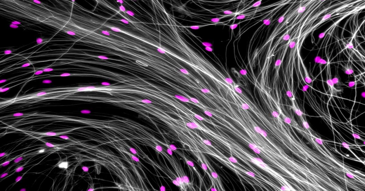 Nerve cells grown from spinal cord stem cells