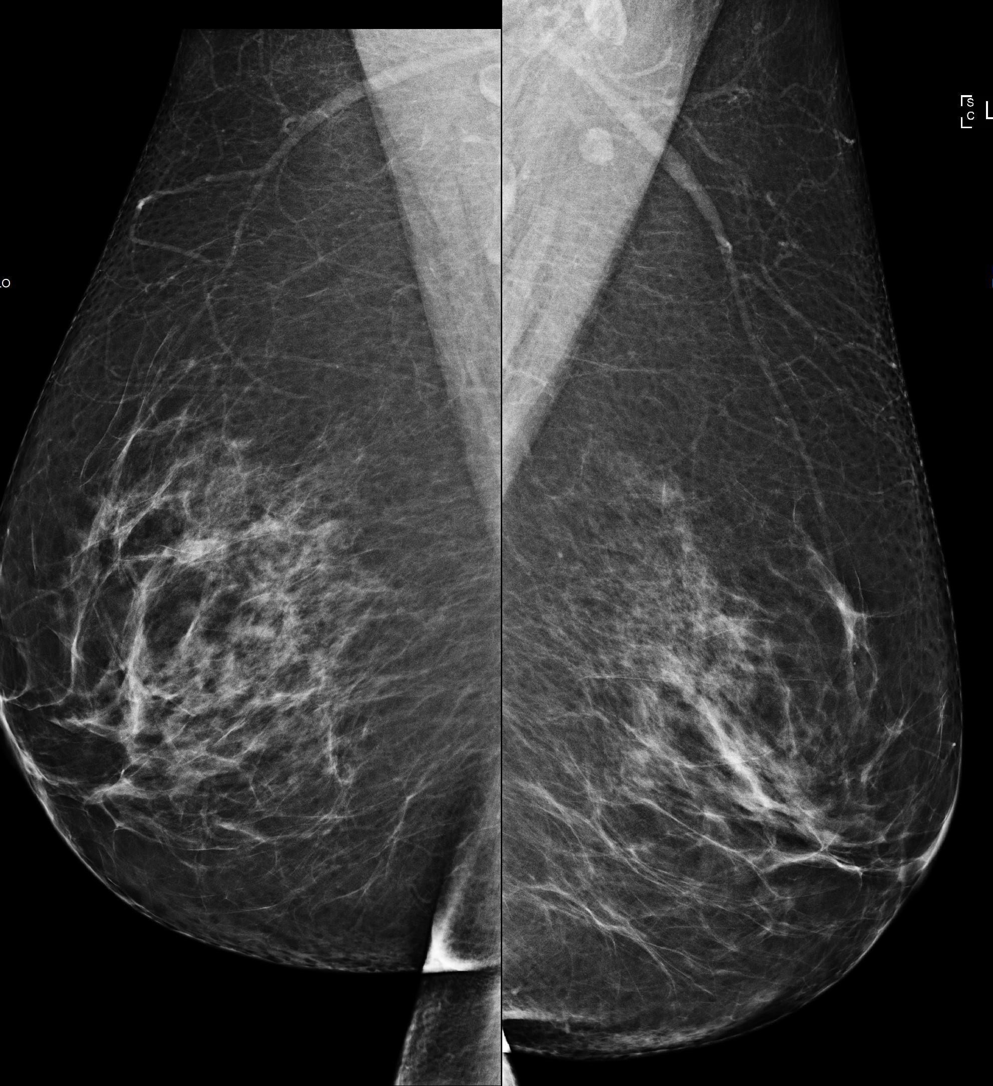 Early Cancer Screening Could Save Canadian Healthcare System Nearly Half a Billion Dollars Over Patients’ Lifetime Early Cancer Screening Could Save Canadian Healthcare System Nearly Half a Billion Dollars Over Patients’ Lifetime