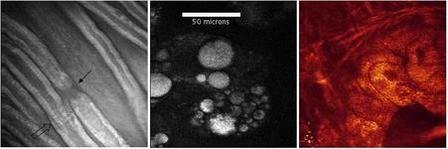 Coherent Anti-Stokes Raman Scattering Microscopy