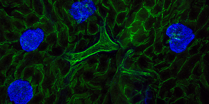 Photo d’une cellule au microscope – Recherche sur les maladies rénales