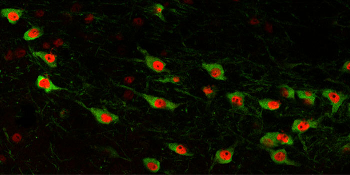 Maladies neurobiologiques