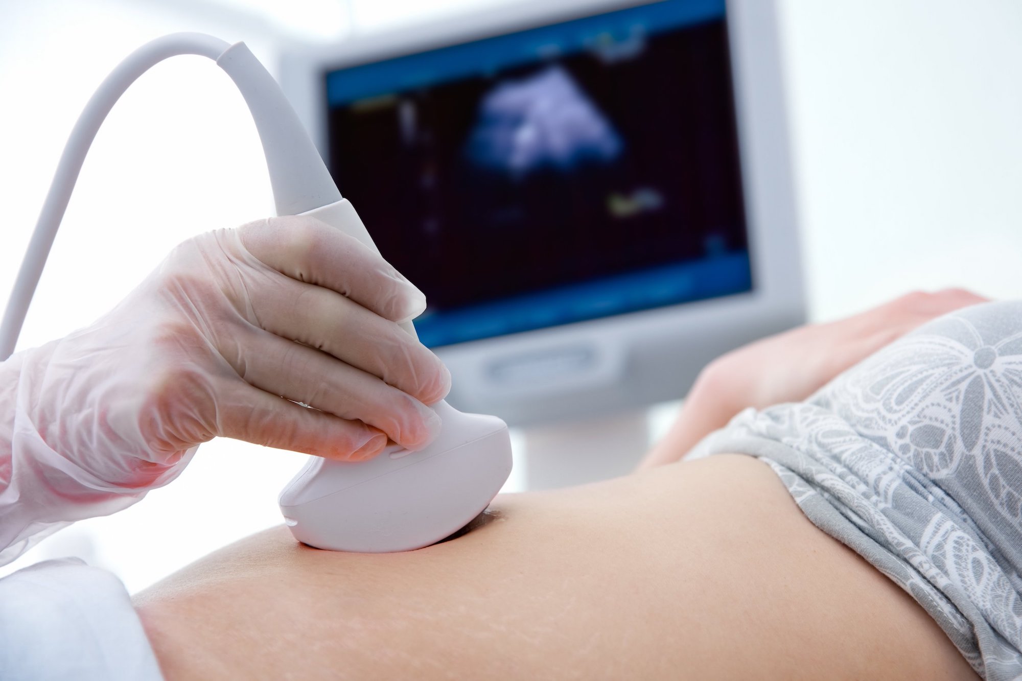 Pregnant woman with an ultra sound check
