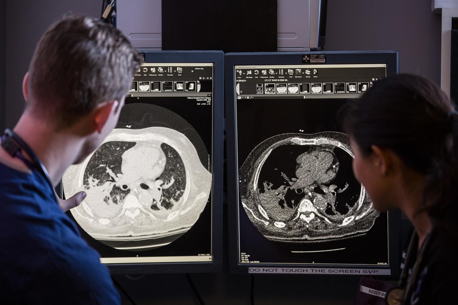 Des médecins discutant d'un diagnostic en regardant des écrans montrant les résultats d'un scanner.