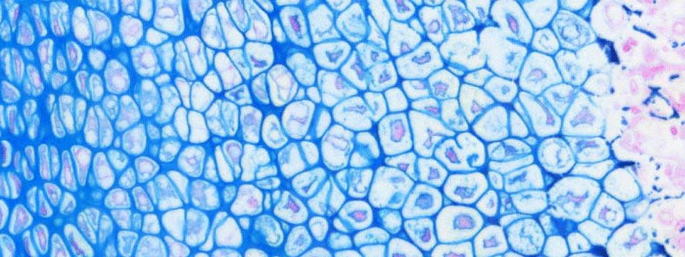 image histologiqueL‘avantage de cette plateforme technologique est le large éventail de connaissances acquises en raison de la diversité et de la complexité des demandes. On pratique des examens histologiques sur presque tout en biologie, des mammifères aux coquilles d’œufs, en passant par le poisson, le riz et les fèves. Grâce à cette diversité, nous apprenons ce à quoi ressemble chaque tissu