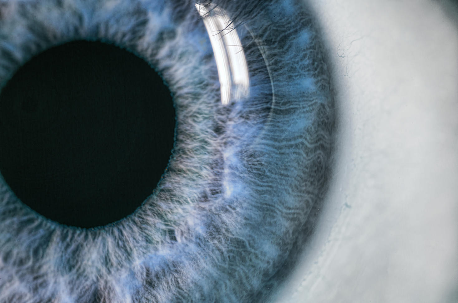 Eye