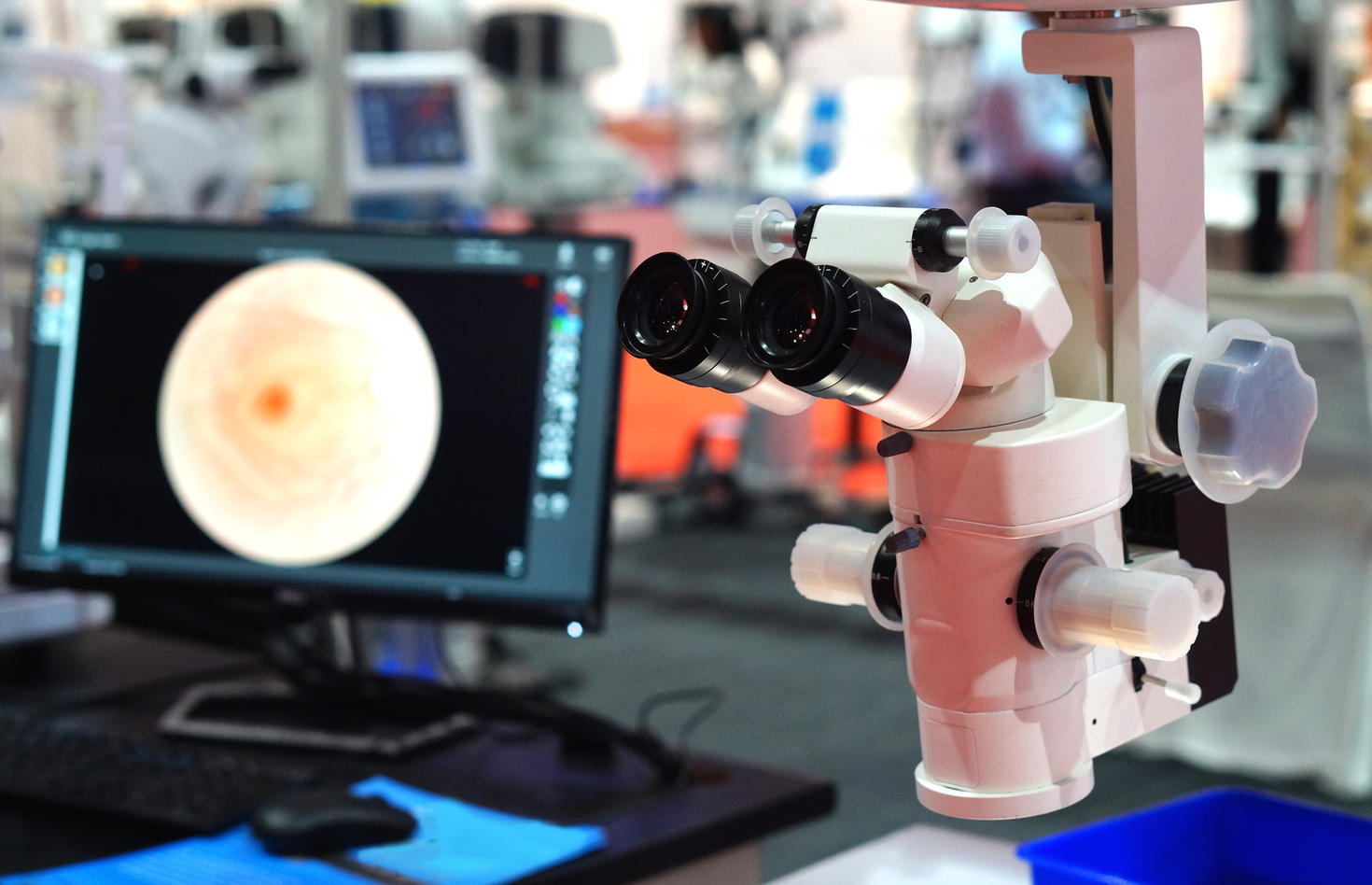 Ophthalmic camera microscope and image of the eye on screen