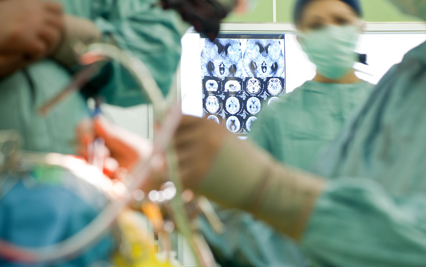Figures floues de personnes en uniforme médical pratiquant une opération du cerveau, focus sur une radiographie