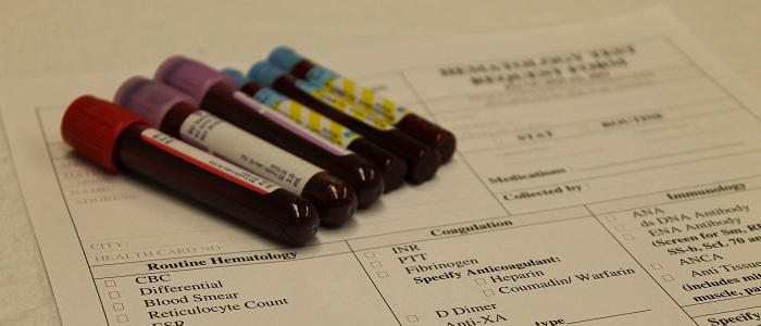 Tubes de sang sur une feuille de réquisition