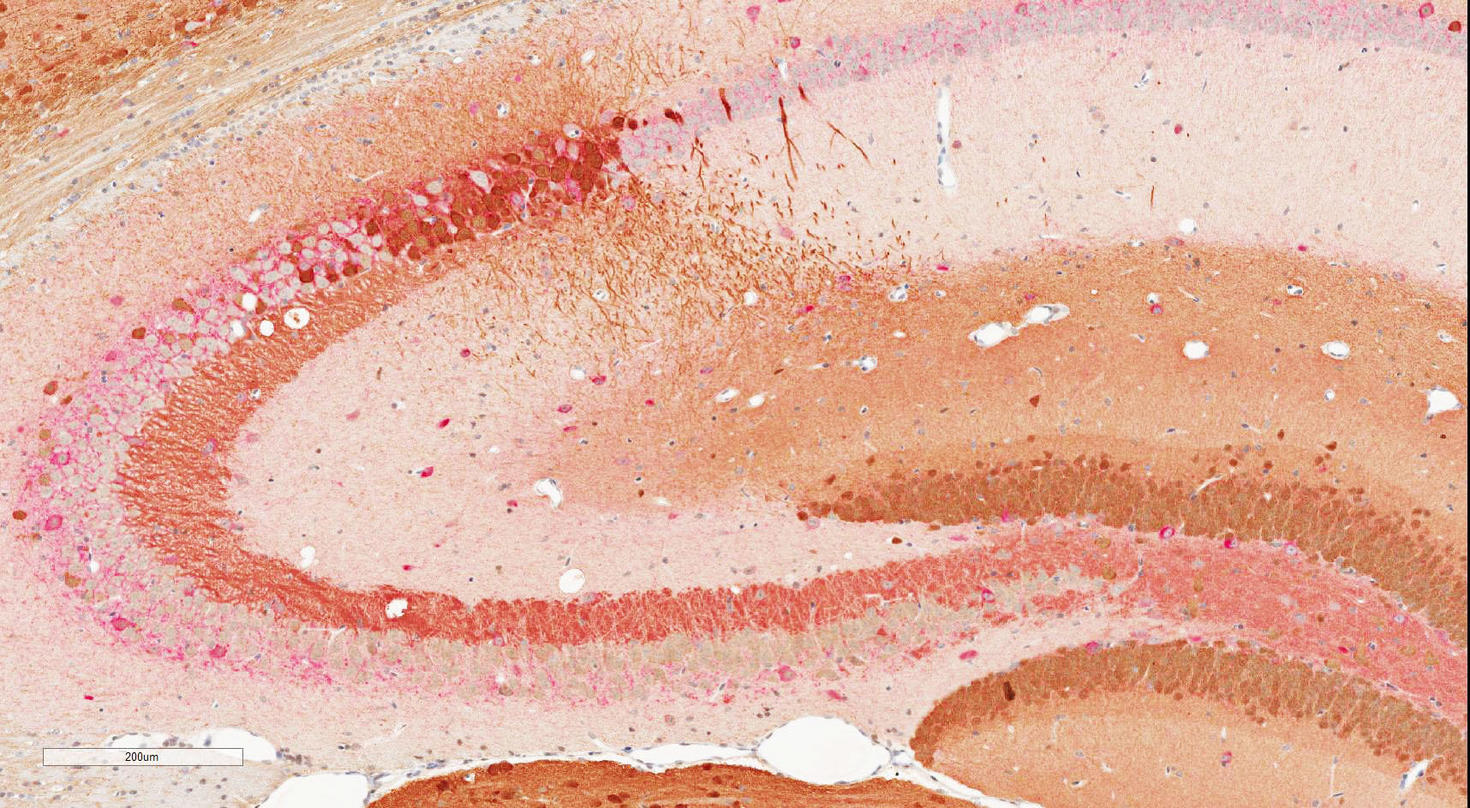 Double marquage par chromogène IHC dans le cerveau de la souris