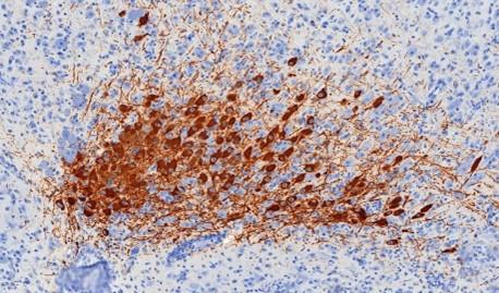 Coloration IHC des neurones dopaminergiques dans le cerveau de la souris