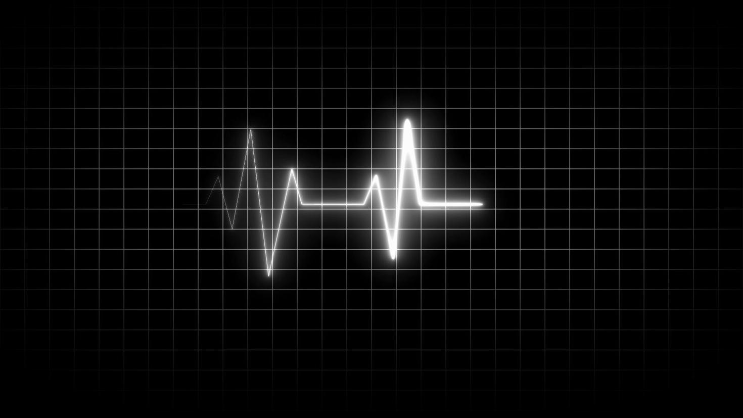 Ligne blanche néon représentant un rythme cardiaque sur fond quadrillé foncé électrocardiogramme