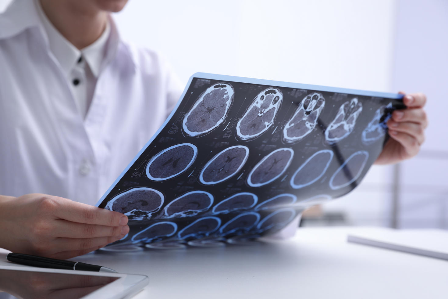 Doctor looking at an MRI scan of a brain