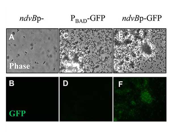 Phase-contrast and fluorescence microscopy images of biofilm cells.