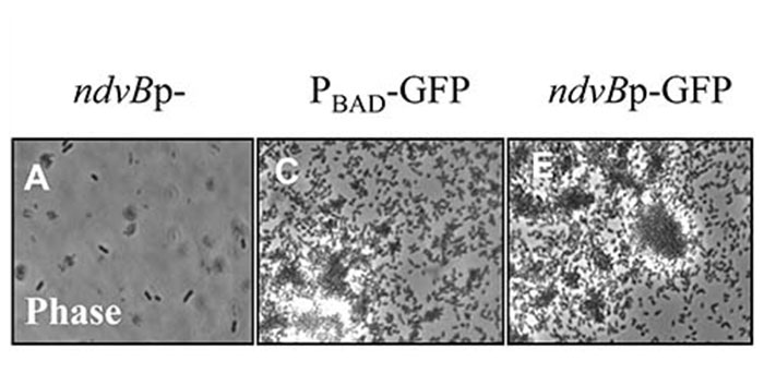 Viral & Bacterial Pathogenesis