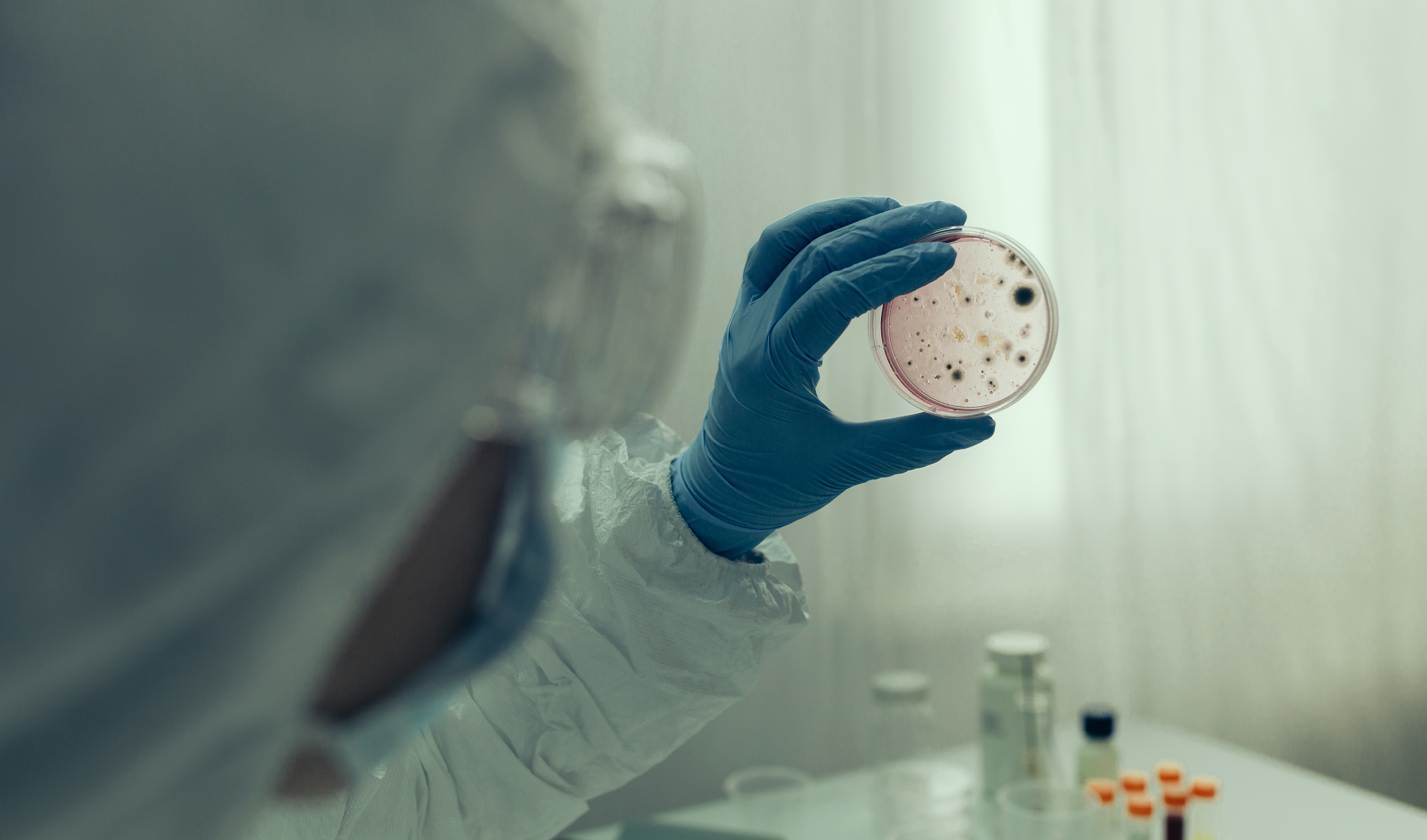Scientist Works with Petri Dishes with Various Bacteria