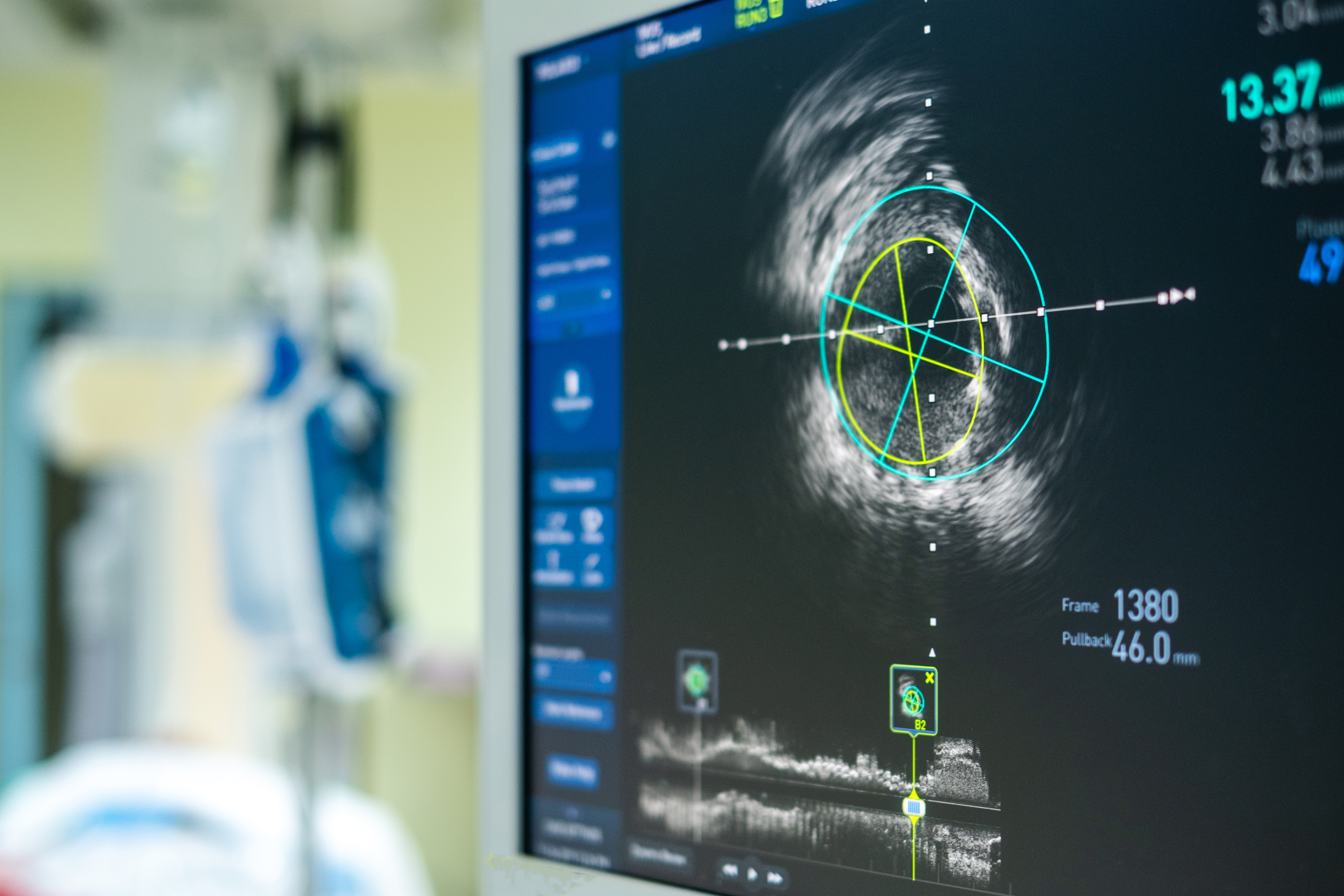 ntravascular ultrasound imaging