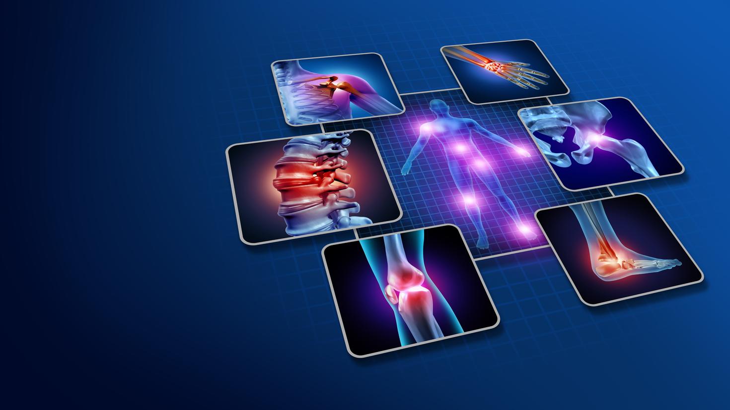 Illustration of body joint pain and arthritis