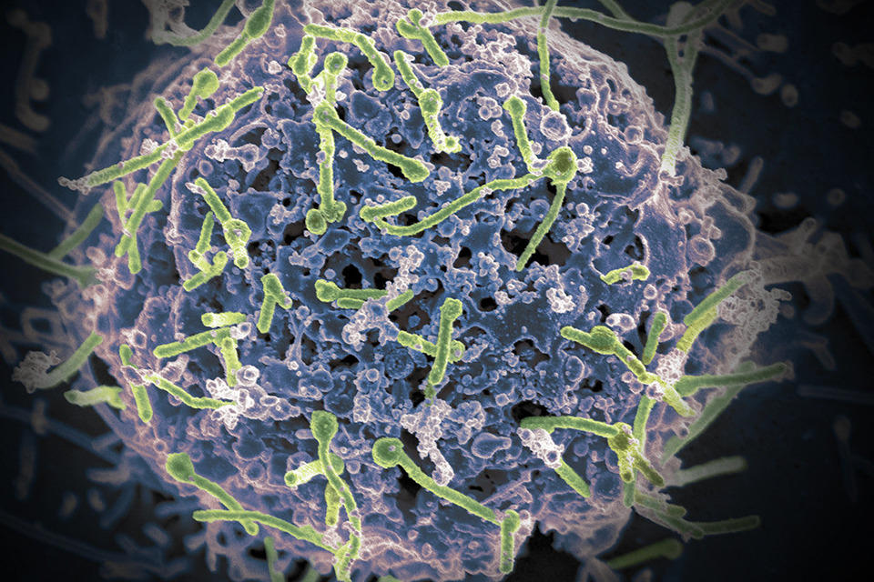 a microscopic view of a virus