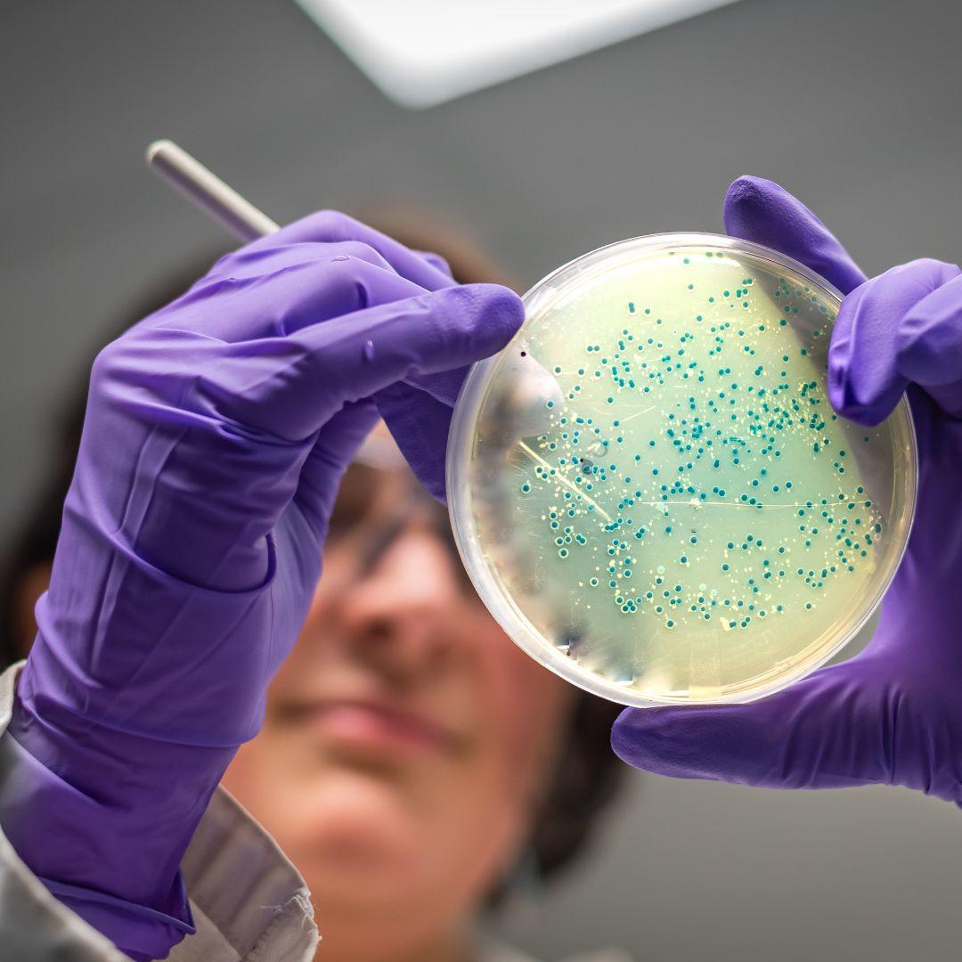 Close up on sample of bacteria. 