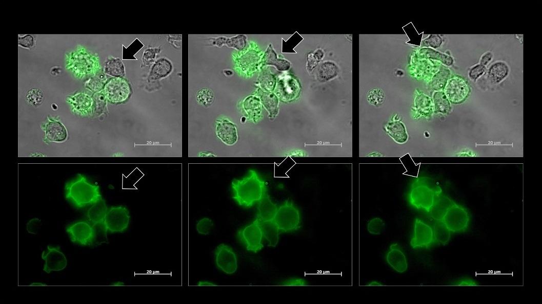 Une cellule tueuse naturelle (indiquée par la flèche) devient verte après avoir prélevé un morceau d’une cellule cancéreuse verte.
