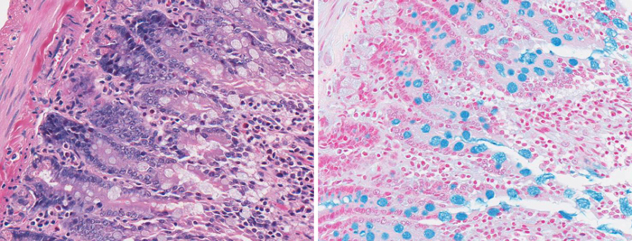 Coloration à l'hématoxyline-éosine (H&E) (à gauche) par rapport à une coloration au bleu Alcian (à droite), mettant en évidence des cellules caliciformes dans l’intestin du rat