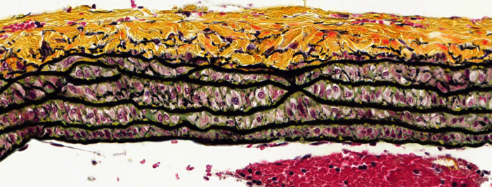 Coloration Movat Pentachrome dans le poumon d’un rat