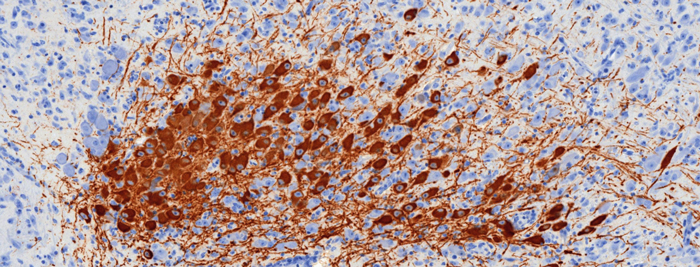 Coloration immunohistochimique mettant en évidence des neurones dopaminergiques dans le cerveau d’un rat