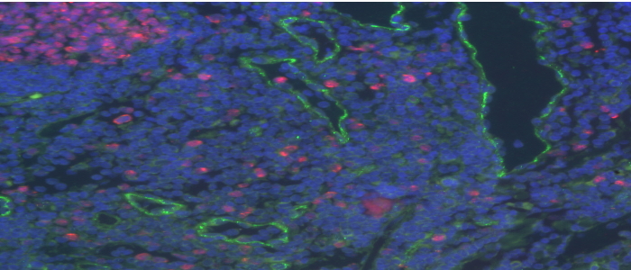 Double marqueur par immunofluorescence dans le cerveau d’une souris
