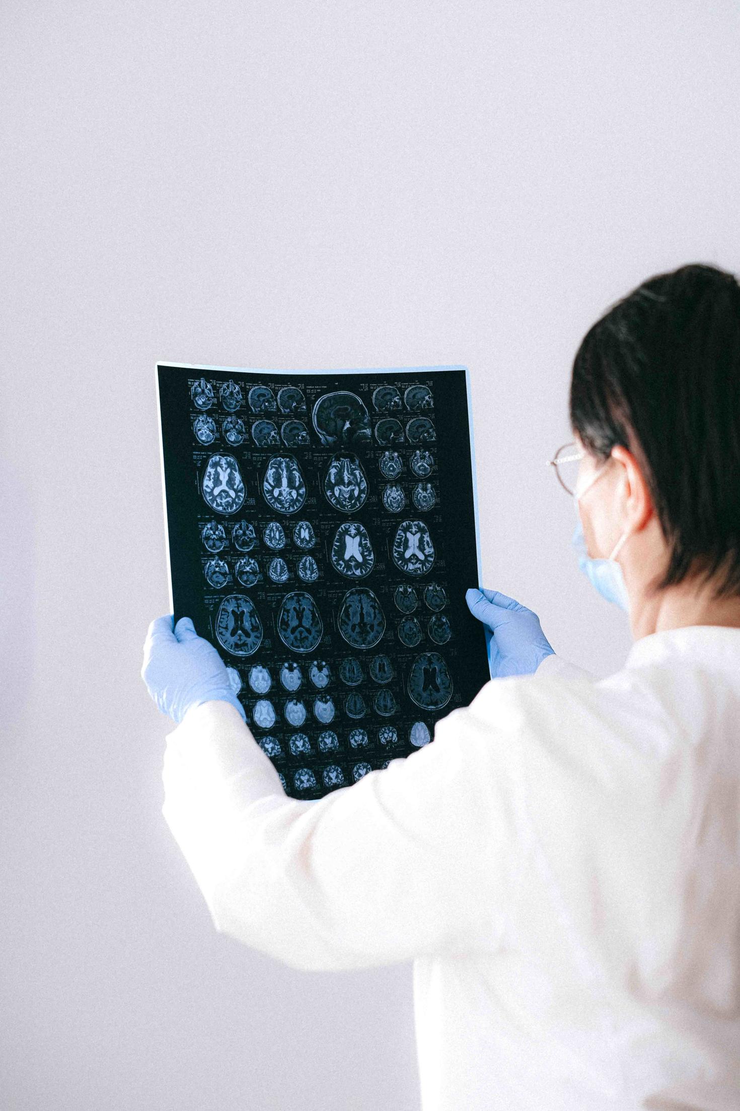 Radiographie cérébrale