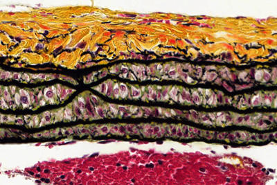 Coloration au pentachrome de Movat dans le poumon d'un rat