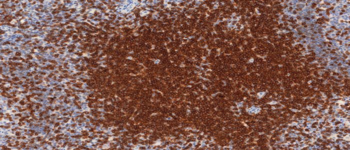 IHC (DAB) staining using CD5 on human tonsil