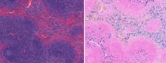 H&E Stain (left) vs Prussian Blue iron stain (right) in mouse spleen