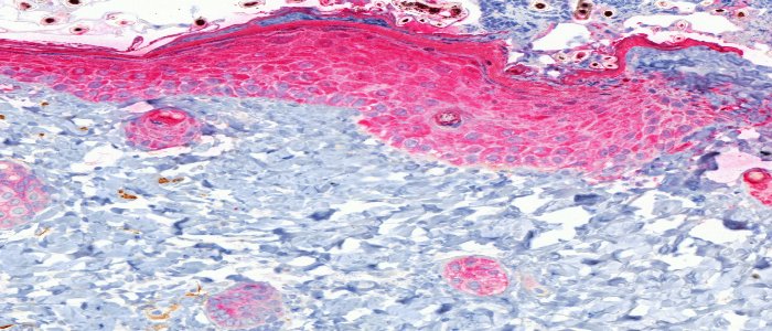 IHC (AP) staining using cytokeratin in mouse skin