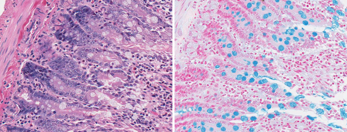H&E Stain (left) vs Alcian Blue Stain (right) showing goblet cells in the rat intestine