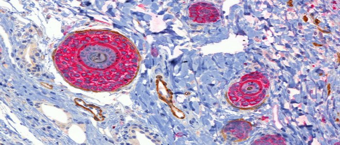 Double labelling by chromogenic IHC in mouse skin