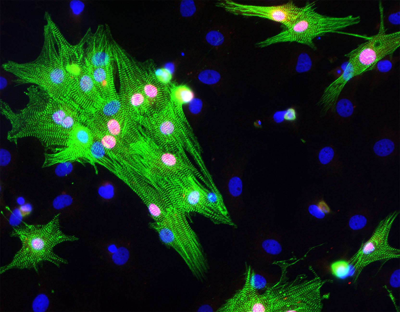 Making stronger cardiomyocytes with cardiac protein PEX1