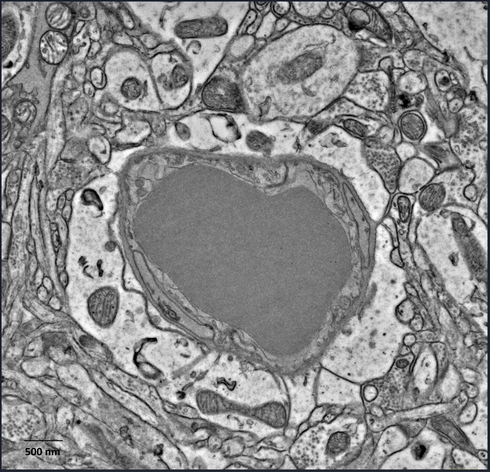 EM image of a blood vessel