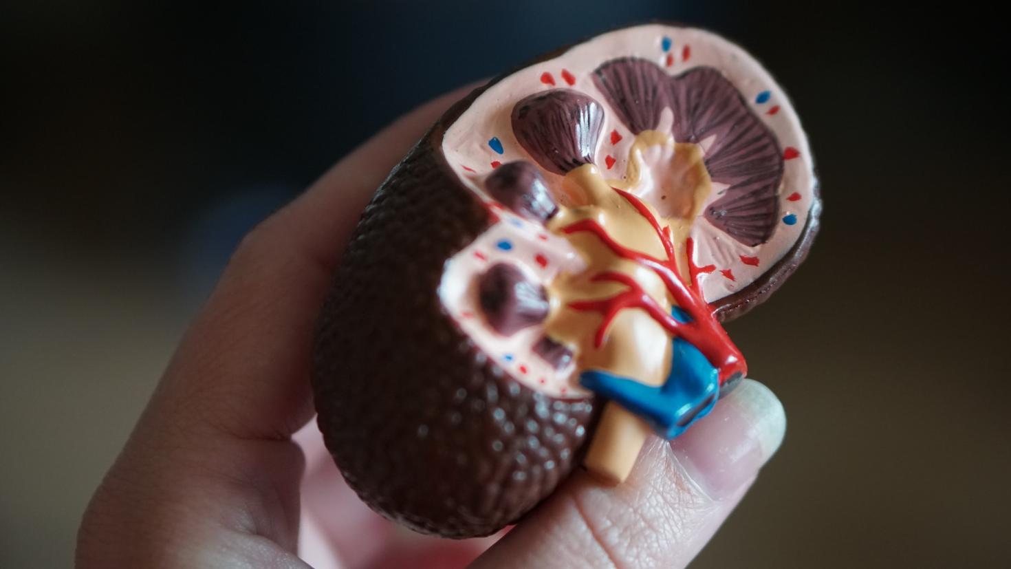 Model of a kidney