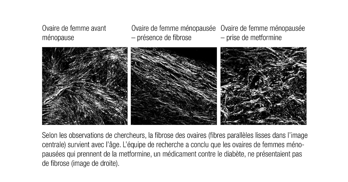 Images de diverses étapes de l'évolution d'un ovaire.