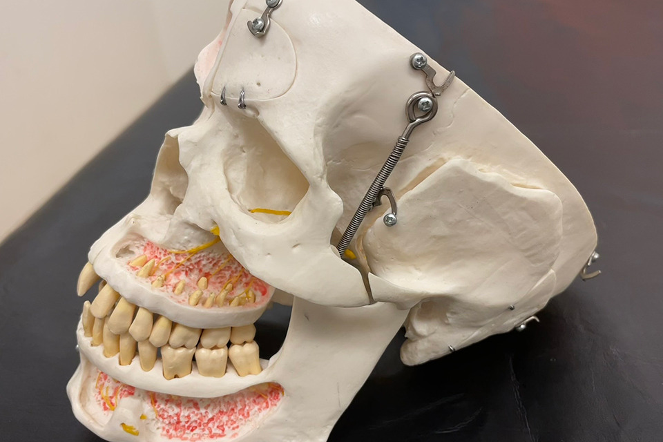 un modèle en plastique d'un crâne humain