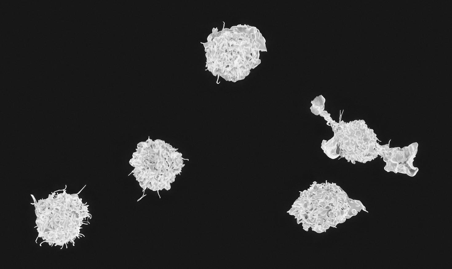 Macrophages Colorized scanning electron micrograph of macrophages