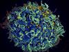 HIV, the AIDS virus (yellow), infecting a human cell